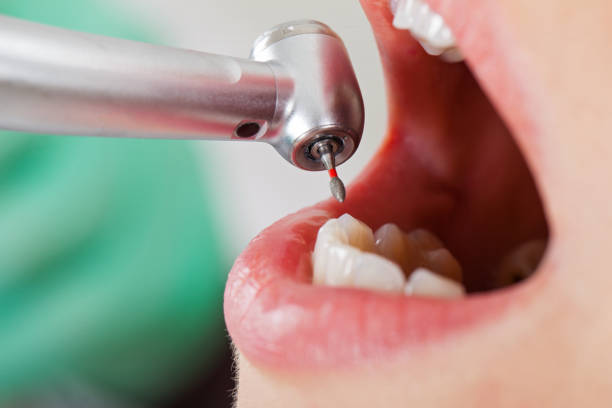 Best Root Canal Emergency Dentist  in Hilltop, SC